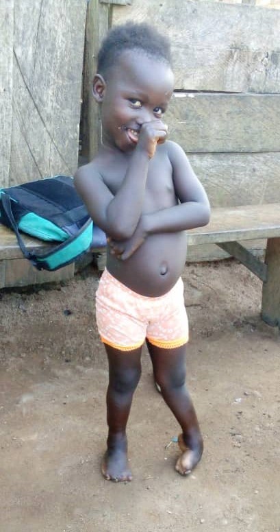 Jana vor ihrer Operation - heute kann sie laufen und springen wie andere Kinder.